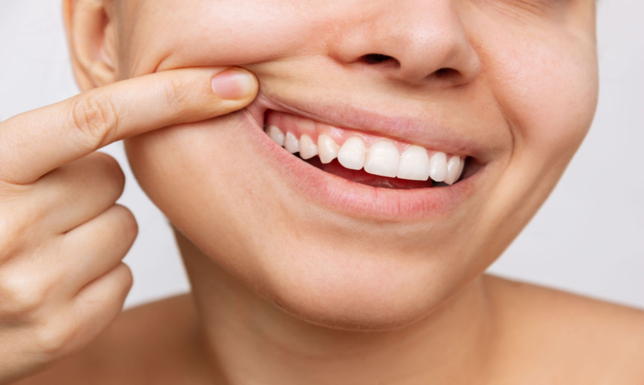 Saúde bucal: saiba como evitar doenças e ter um sorriso bonito