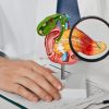 Câncer de pâncreas: saiba quais os primeiros sinais da doença