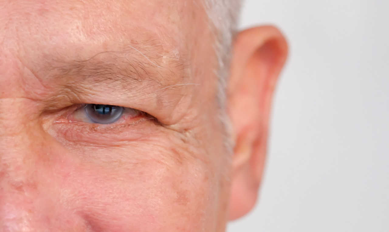 Maio verde: glaucoma não apresenta sinais e é irreversível