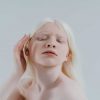 Dia do Albinismo: quais os cuidados necessários com a pele albina?