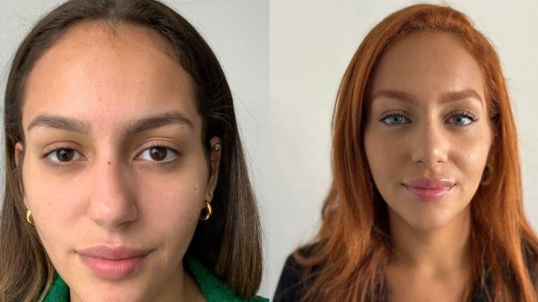 Brasileira viraliza após mudar cor dos olhos: entenda o procedimento