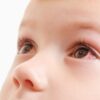 Crianças também têm glaucoma! Entenda a condição